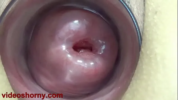 HD Uterus Penetration with Objects, Pumping Cervix Prolapse power Movies