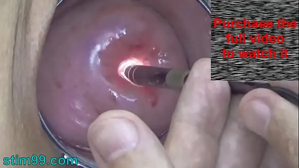 HD Endoscope Camera inside Cervix Cam into Pussy Uterus power Movies