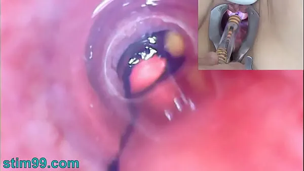 HD Mature Woman Peehole Endoscope Camera in Bladder with Balls power Movies